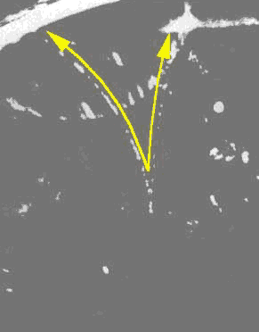 This is a picture of the creation of a pair of particles, revealed by the spots they make in passing through a cloud chamber. The two particles, curving apart under the influence of a magnet, were created in the annihilation of a particle of light (coming invisibly from below). This photograph not only shows the conversion of energy to mass, but confirms Einstein's idea that a light-particle will yield up its quantum of energy all at once in a single burst.