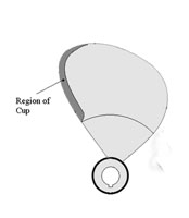 Cup
                              placing