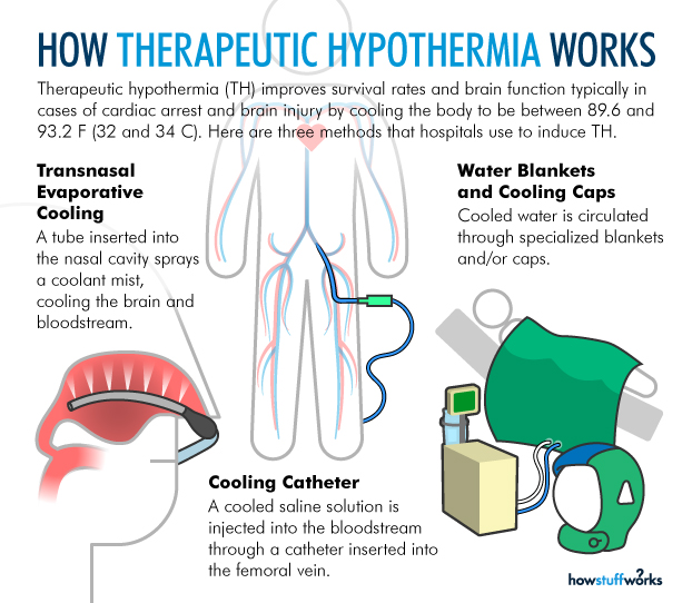 Theraputic
                          Hypothermia