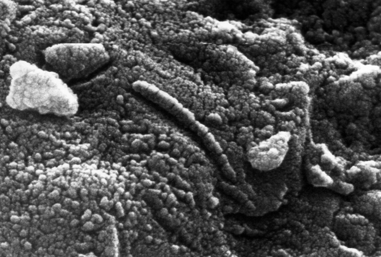 Martian_Microbe